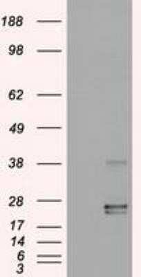 Western Blot: Oncostatin M/OSM Antibody (OTI2B6)Azide and BSA Free [NBP2-73146]