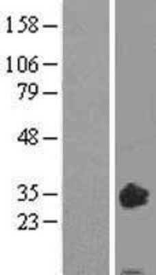 Western Blot: Oncostatin M/OSM Overexpression Lysate [NBL1-14002]