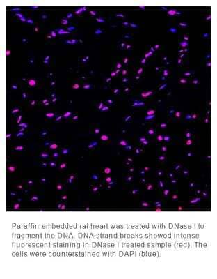 Fluorescence Imaging: OneStep TUNEL Apoptosis Kit [Red, 555] [NBP3-12093]