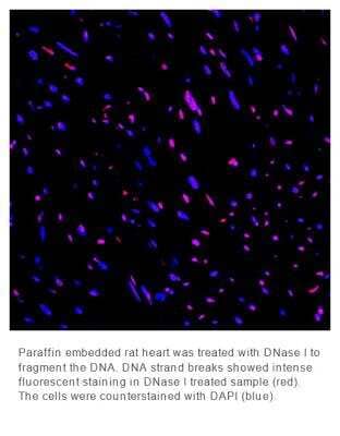 Fluorescence Imaging: OneStep TUNEL Apoptosis Kit [Red, 594] [NBP3-11959]