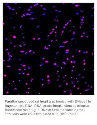 Fluorescence Imaging: OneStep TUNEL Apoptosis Kit [Red, 647] [NBP3-11962]