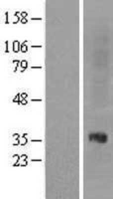 Western Blot: ORL1/OPRL1 Overexpression Lysate [NBL1-13945]