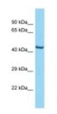 Western Blot: Opsin 1 (Medium Wave) Antibody [NBP1-98471]