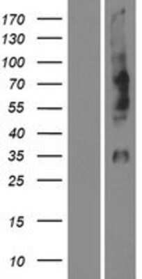 Western Blot: Opsin 1 (Medium Wave) Overexpression Lysate [NBP2-10678]