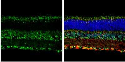 Immunohistochemistry-Frozen: Opsin 3 Antibody [NBP2-19629]