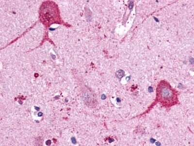 Immunohistochemistry-Paraffin: Opsin 3 Antibody - BSA Free [NLS2133]