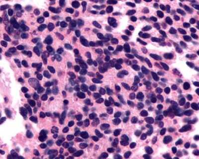 Immunohistochemistry-Paraffin: Opsin 3 Antibody - BSA Free [NLS2133]