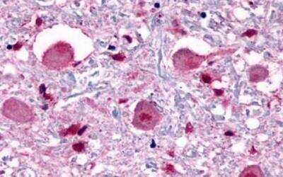 Immunohistochemistry-Paraffin: Opsin 3 Antibody - BSA Free [NLS2133]