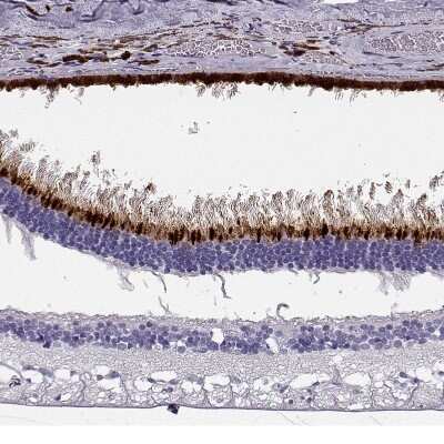 Immunohistochemistry-Paraffin: Opsin 5 Antibody [NBP2-55250]