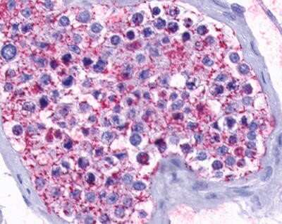 Immunohistochemistry-Paraffin: Opsin 5 Antibody - BSA Free [NLS2144]