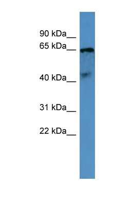 Western Blot: Opsin 5 Antibody [NBP1-69038]