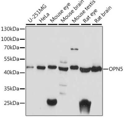 Western Blot: Opsin 5 AntibodyAzide and BSA Free [NBP2-94478]