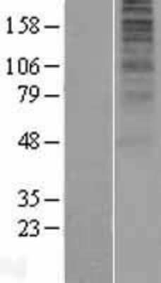 Western Blot: Opsin 5 Overexpression Lysate [NBP2-04896]