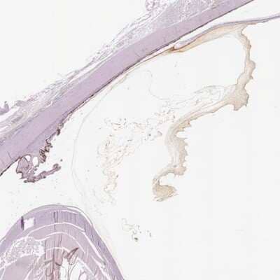 Immunohistochemistry-Paraffin: Opticin Antibody [NBP1-85914]
