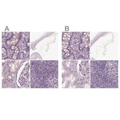 Immunohistochemistry-Paraffin: Opticin Antibody [NBP1-85914]