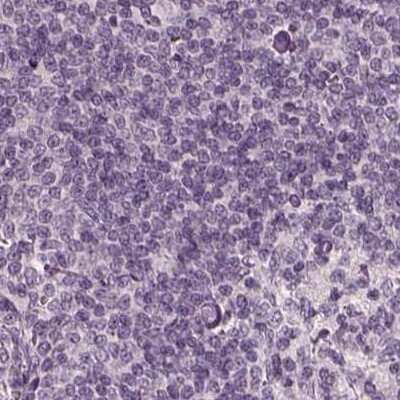 Immunohistochemistry-Paraffin: Opticin Antibody [NBP1-85914]