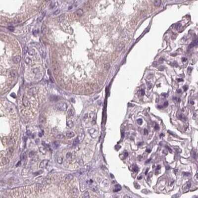 Immunohistochemistry-Paraffin: Opticin Antibody [NBP1-85914]