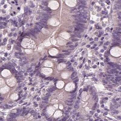 Immunohistochemistry-Paraffin: Opticin Antibody [NBP1-85914]