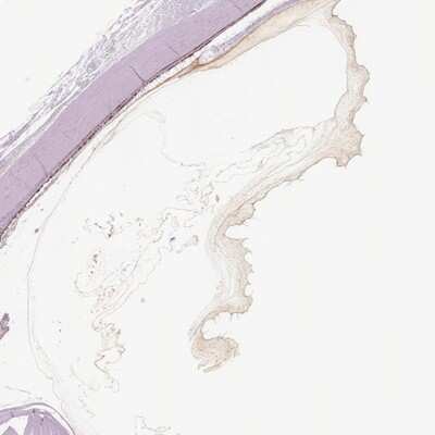 Immunohistochemistry-Paraffin: Opticin Antibody [NBP2-55115]