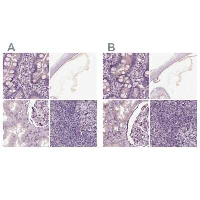 Immunohistochemistry-Paraffin: Opticin Antibody [NBP2-55115]