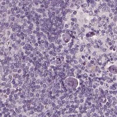 Immunohistochemistry-Paraffin: Opticin Antibody [NBP2-55115]