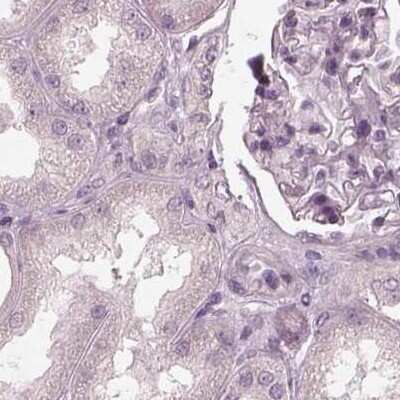 Immunohistochemistry-Paraffin: Opticin Antibody [NBP2-55115]