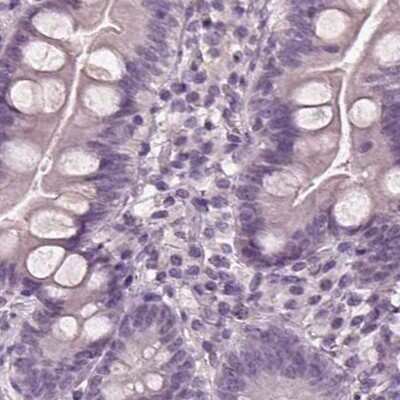 Immunohistochemistry-Paraffin: Opticin Antibody [NBP2-55115]
