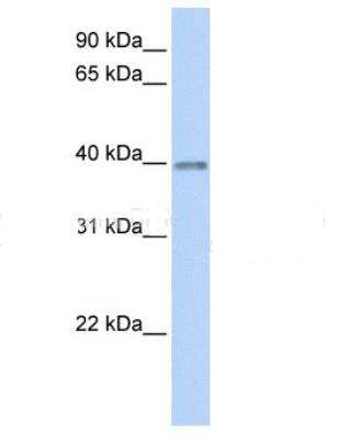 Western Blot: Opticin Antibody [NBP1-79568]