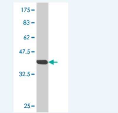 Western Blot: Optimedin Antibody (1F11) [H00118427-M01]