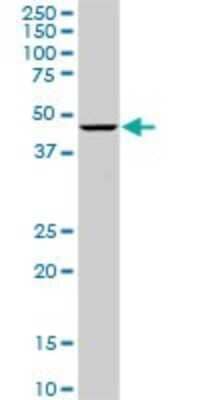 Western Blot: Optimedin Antibody (3A2) [H00118427-M06]