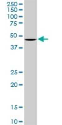 Western Blot: Optimedin Antibody (3A2) [H00118427-M06]