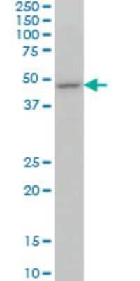 Western Blot: Optimedin Antibody (3A2) [H00118427-M06]