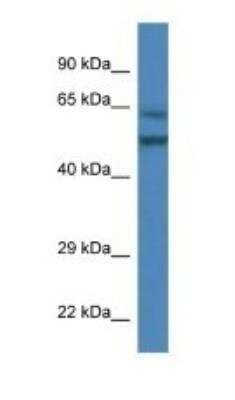 Western Blot: Optimedin Antibody [NBP1-74249]