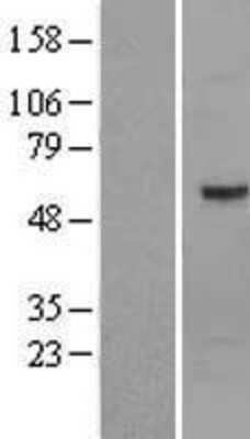 Western Blot: Optimedin Overexpression Lysate [NBL1-13927]