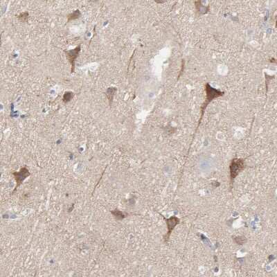 Immunohistochemistry-Paraffin: Optineurin Antibody [NBP1-84682]