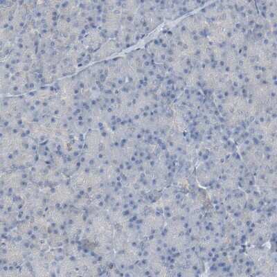 Immunohistochemistry-Paraffin: Optineurin Antibody [NBP1-84682]