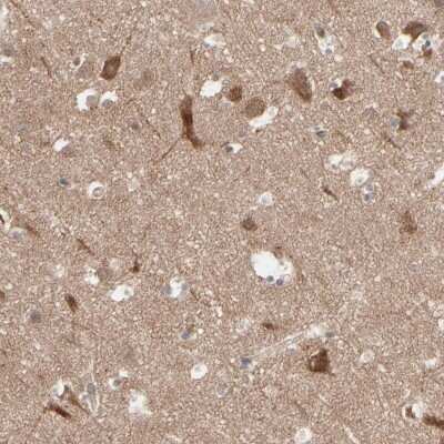 Immunohistochemistry-Paraffin: Optineurin Antibody [NBP1-84683]