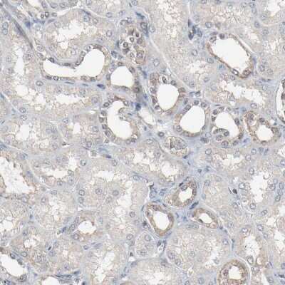 Immunohistochemistry-Paraffin: Optineurin Antibody [NBP1-84683]