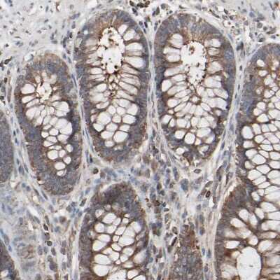 Immunohistochemistry-Paraffin: Optineurin Antibody [NBP1-84683]