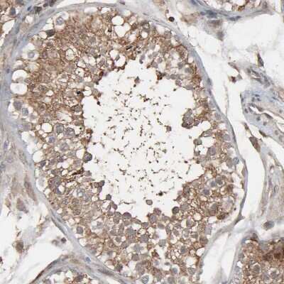 Immunohistochemistry-Paraffin: Optineurin Antibody [NBP1-84683]