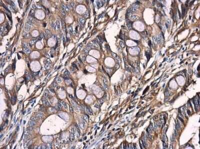 Immunohistochemistry-Paraffin: Optineurin Antibody [NBP3-13114]