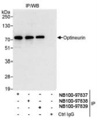 Immunoprecipitation: Optineurin Antibody [NB100-97837]