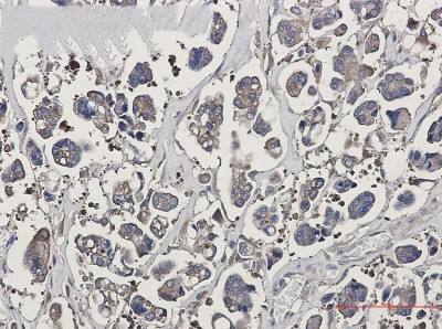 Immunohistochemistry-Paraffin: Optineurin Antibody (S01-2C5) [NBP3-19900]