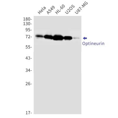 Western Blot: Optineurin Antibody (S01-2C5) [NBP3-19900]