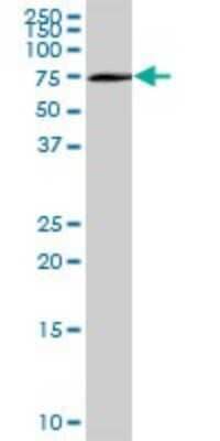 Western Blot: Optineurin Antibody [H00010133-B01P]