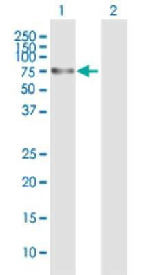 Western Blot: Optineurin Antibody [H00010133-B01P]