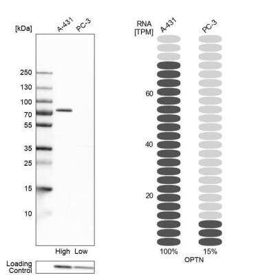 Western Blot: Optineurin Antibody [NBP1-84682]