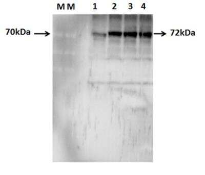 Western Blot: Optineurin Antibody [NBP1-84682]
