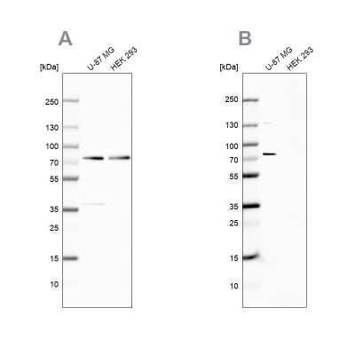 Western Blot: Optineurin Antibody [NBP1-84682]
