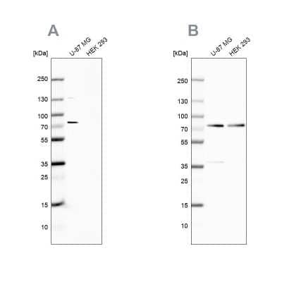 Western Blot: Optineurin Antibody [NBP1-84683]